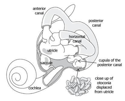 Otoconia