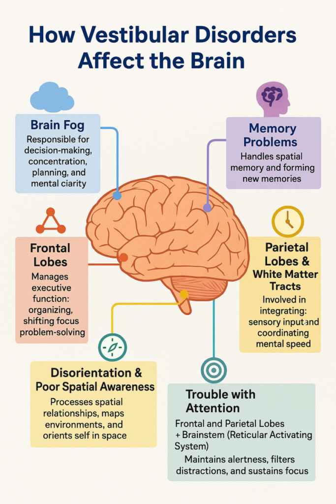 How Vestibular Disorders Affect the Brain infographic