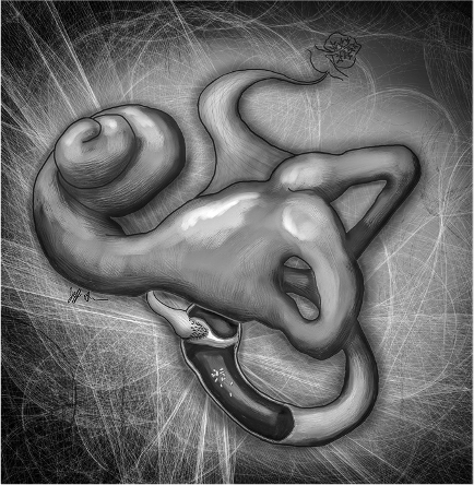 Like a Rolling Stone: BPPV