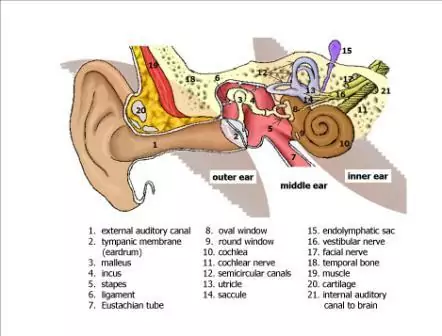 Labyrinthitis And Vestibular Neuritis - Veda