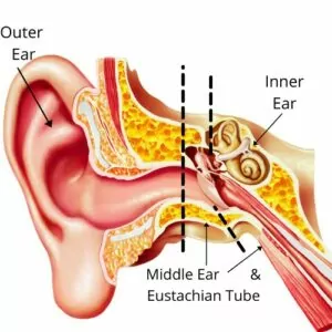 plane travel ear problems