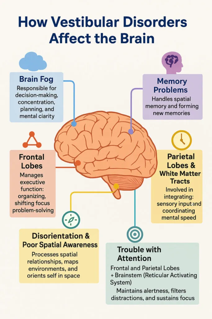 How Vestibular Disorders Affect the Brain infographic